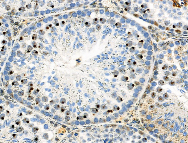 Phospho-Trf2 (Ser365) Antibody in Immunohistochemistry (Paraffin) (IHC (P))