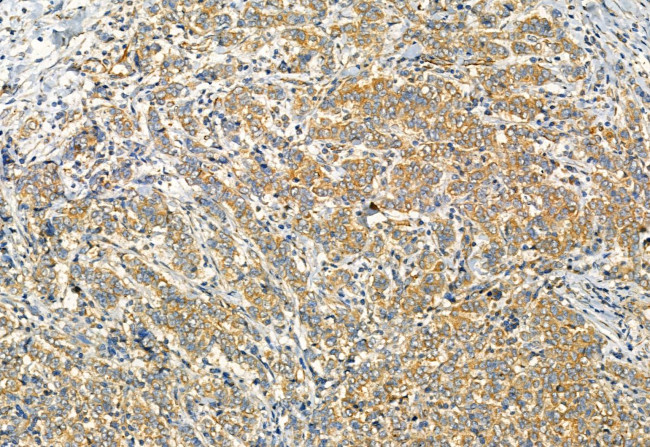 Phospho-TRPV1 (Ser502) Antibody in Immunohistochemistry (Paraffin) (IHC (P))