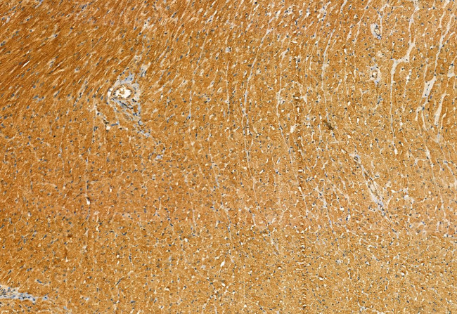 Phospho-TRPV1 (Ser502) Antibody in Immunohistochemistry (Paraffin) (IHC (P))