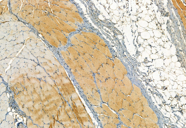 Phospho-TRPV1 (Ser502) Antibody in Immunohistochemistry (Paraffin) (IHC (P))