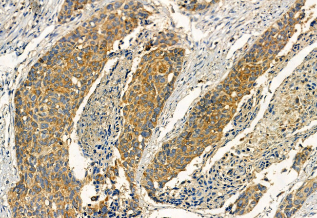 Phospho-TRPV1 (Ser502) Antibody in Immunohistochemistry (Paraffin) (IHC (P))