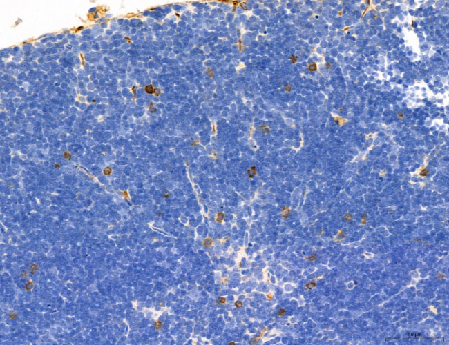 Phospho-Axl (Tyr702) Antibody in Immunohistochemistry (Paraffin) (IHC (P))