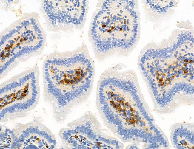 Phospho-Axl (Tyr702) Antibody in Immunohistochemistry (Paraffin) (IHC (P))