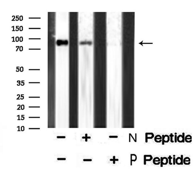 Phospho-Axl (Tyr702) Antibody in Western Blot (WB)