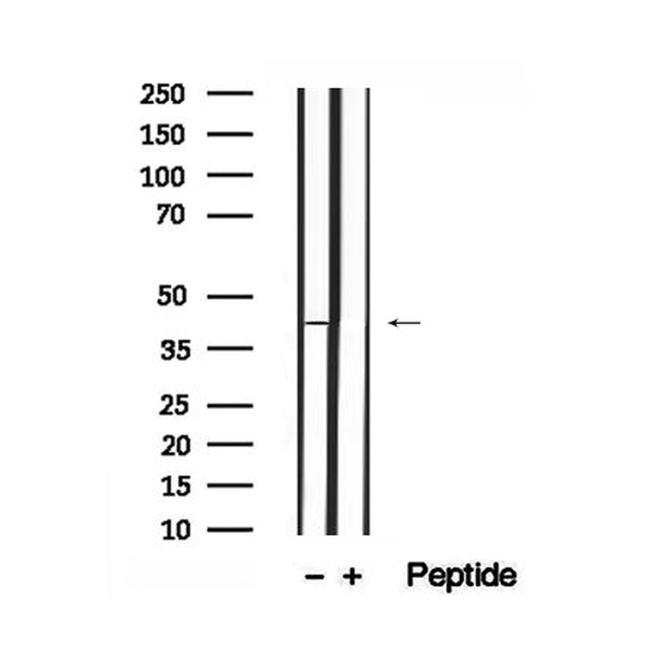 Phospho-PGK1 (Tyr324) Antibody in Western Blot (WB)