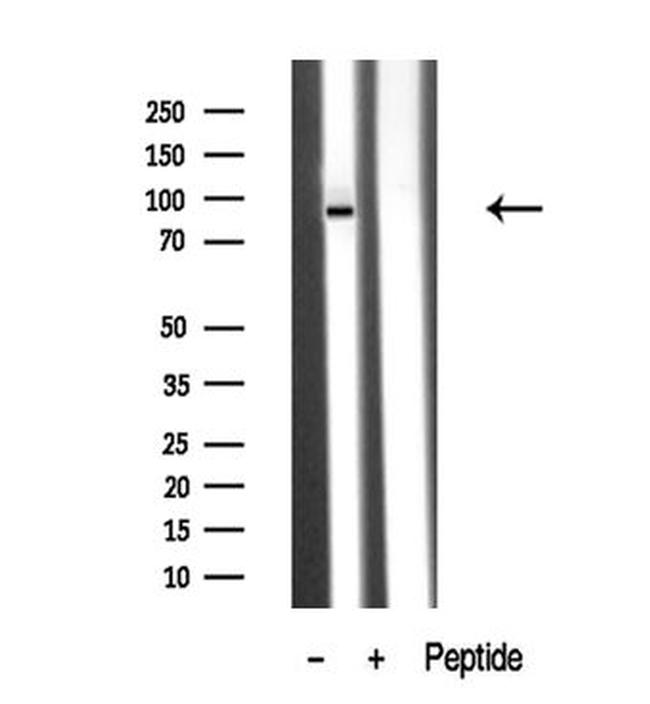 PKD2 Antibody in Western Blot (WB)