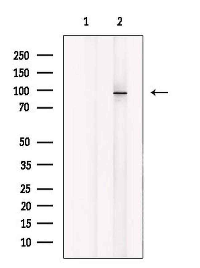 MARK Pan Antibody in Western Blot (WB)