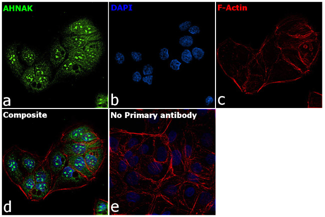 AHNAK Antibody in Immunocytochemistry (ICC/IF)