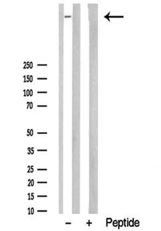 AHNAK Antibody in Western Blot (WB)