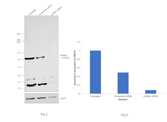 AHNAK Antibody in Western Blot (WB)