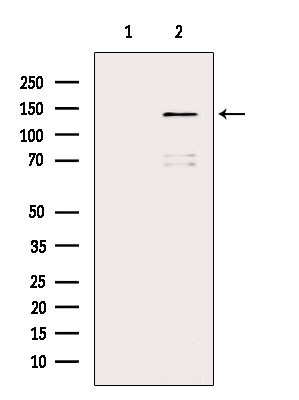 ABL1/ABL2 Antibody in Western Blot (WB)