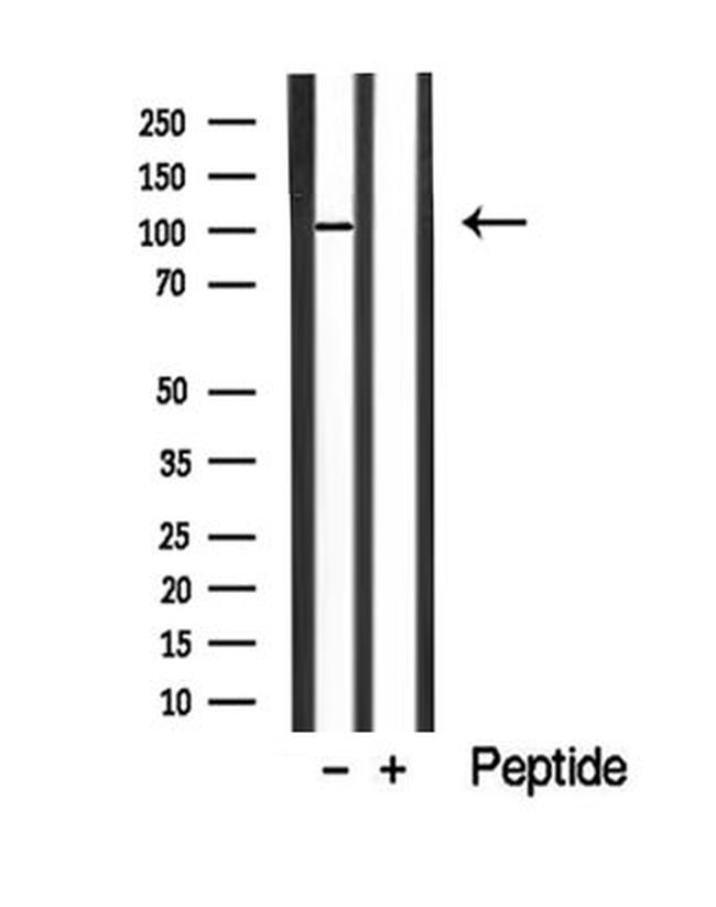 EphA8 Antibody in Western Blot (WB)