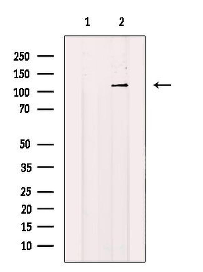 EphA8 Antibody in Western Blot (WB)