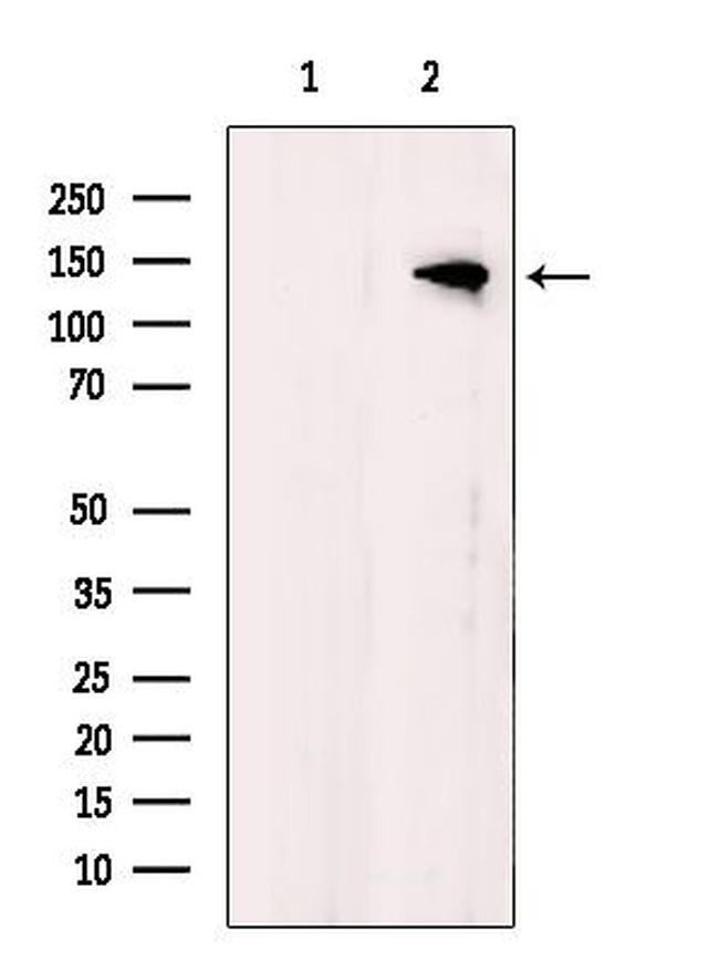 JAK2/JAK3 Antibody in Western Blot (WB)