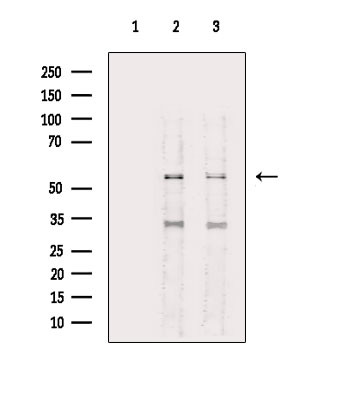 STK38/STK38L Antibody in Western Blot (WB)