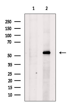 STK38/STK38L Antibody in Western Blot (WB)