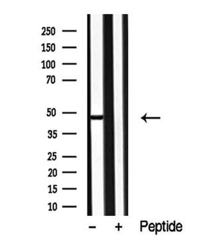 p38 MAPK gamma/delta Antibody in Western Blot (WB)