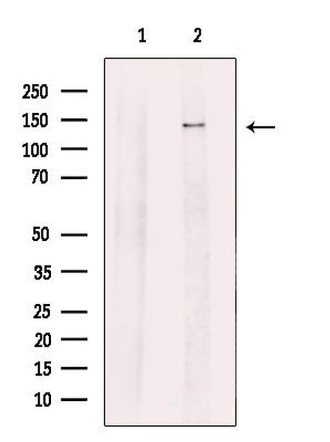 SIK1/SIK2/SIK3 Antibody in Western Blot (WB)