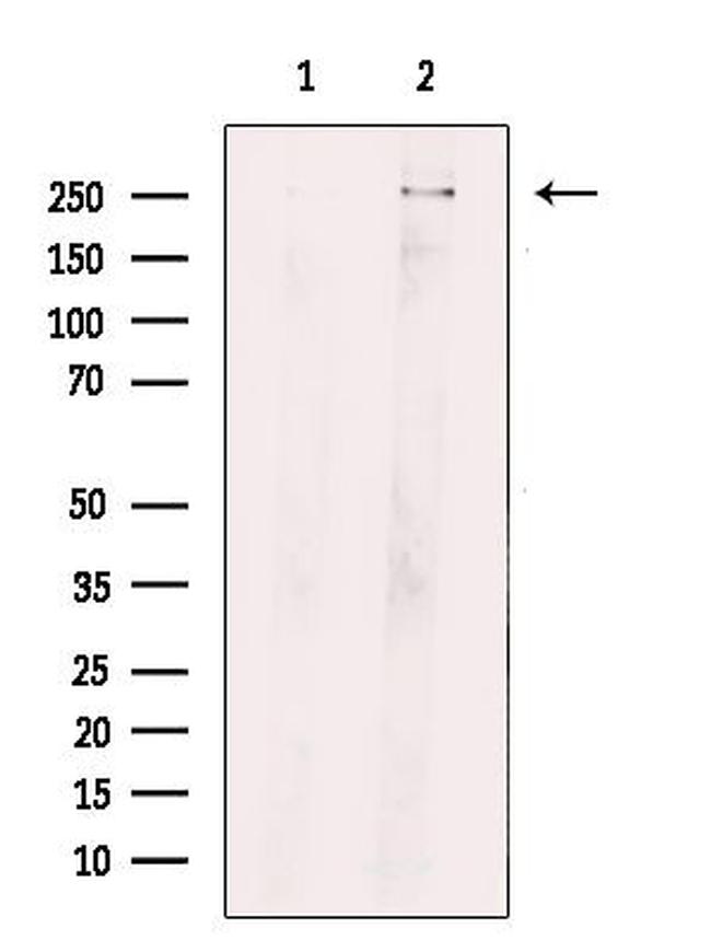 ROS1 Antibody in Western Blot (WB)