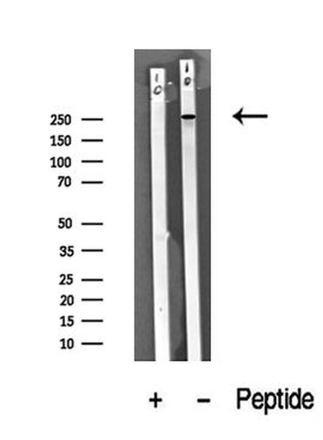 ROS1 Antibody in Western Blot (WB)