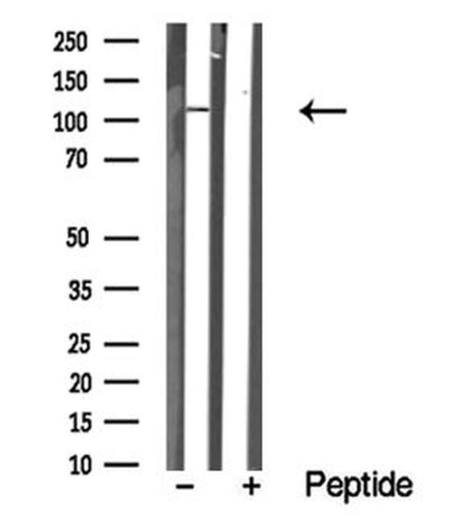 MERTK Antibody in Western Blot (WB)