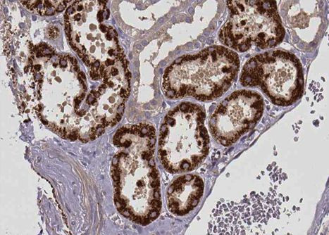 CPT1A Antibody in Immunohistochemistry (Paraffin) (IHC (P))