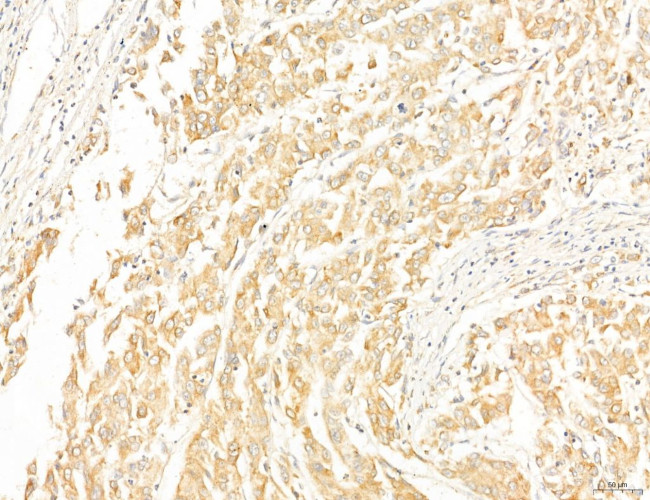 CPT1A Antibody in Immunohistochemistry (Paraffin) (IHC (P))