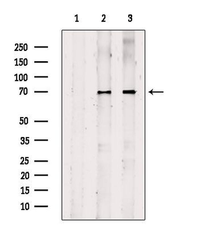 CPT1A Antibody in Western Blot (WB)