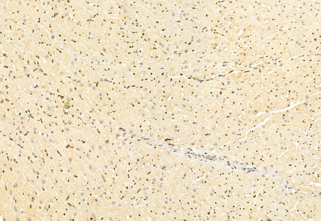 DACH1 Antibody in Immunohistochemistry (Paraffin) (IHC (P))