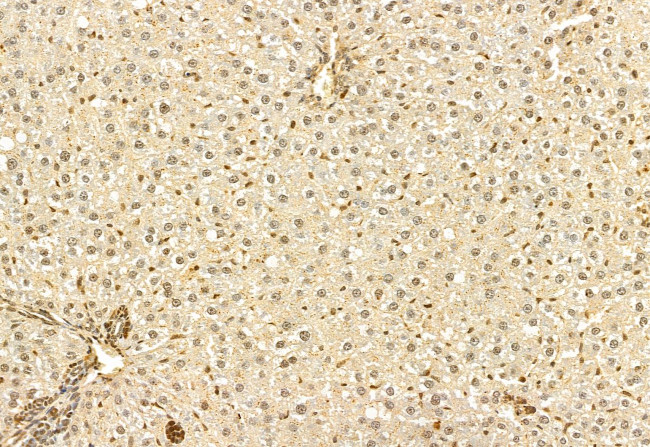 DACH1 Antibody in Immunohistochemistry (Paraffin) (IHC (P))