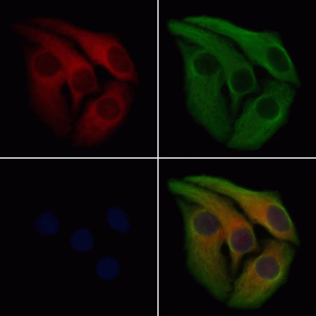 PADI2 Antibody in Immunocytochemistry (ICC/IF)