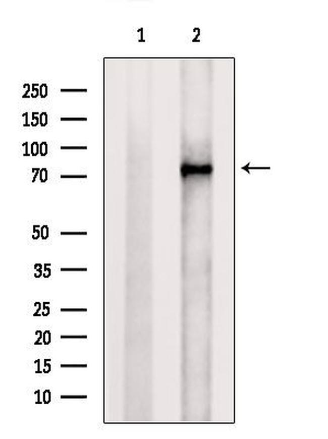 PADI2 Antibody in Western Blot (WB)