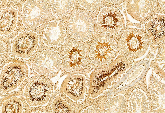 IFT140 Antibody in Immunohistochemistry (Paraffin) (IHC (P))