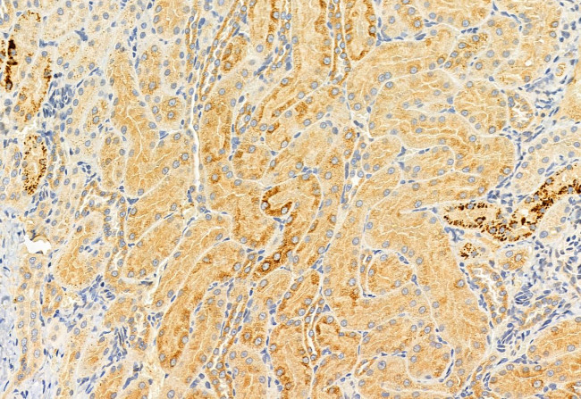 SRXN1 Antibody in Immunohistochemistry (Paraffin) (IHC (P))