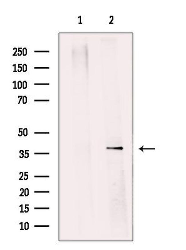 SGTA Antibody in Western Blot (WB)