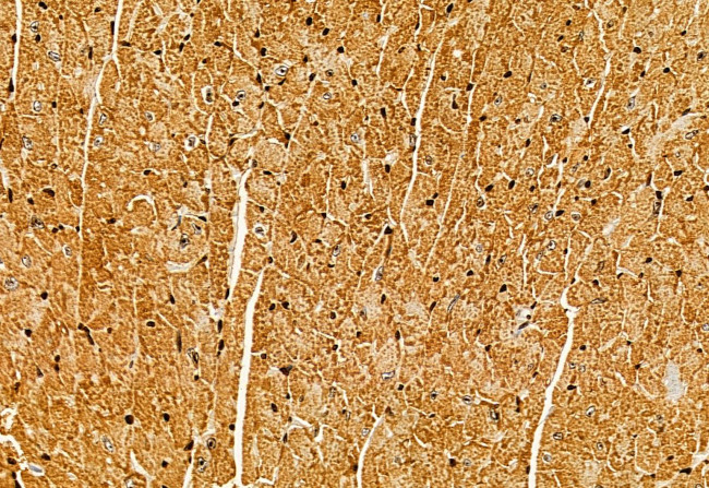 CISD1 Antibody in Immunohistochemistry (Paraffin) (IHC (P))