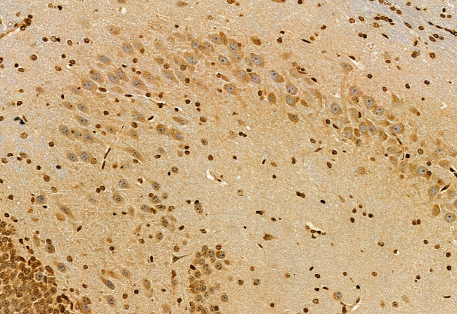 S100A14 Antibody in Immunohistochemistry (Paraffin) (IHC (P))