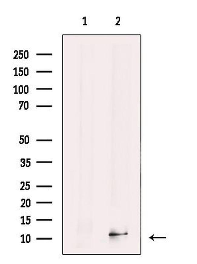 S100A14 Antibody in Western Blot (WB)