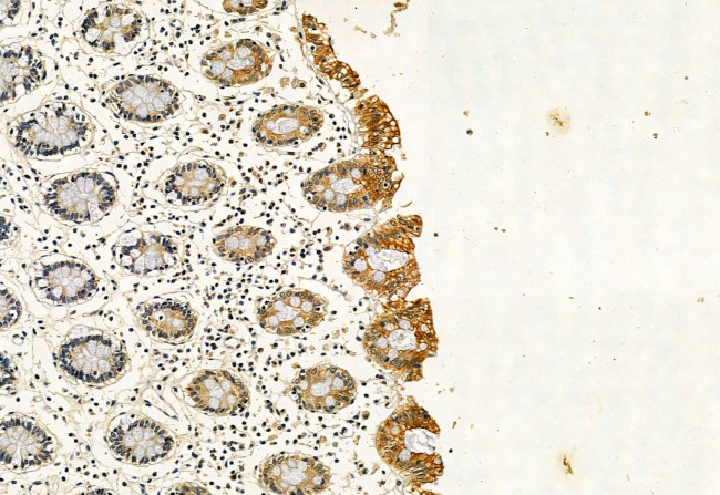 NBR1 Antibody in Immunohistochemistry (Paraffin) (IHC (P))