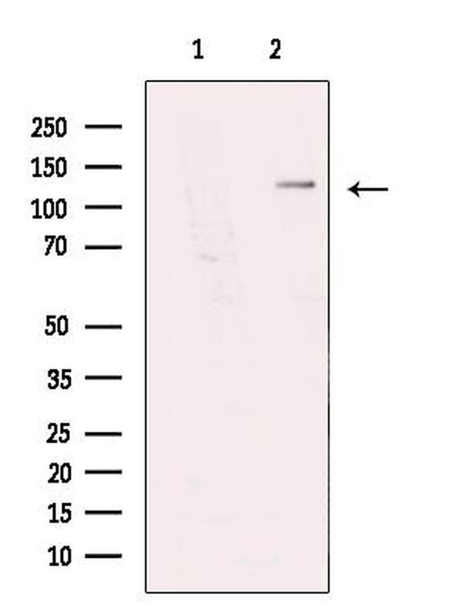 NBR1 Antibody in Western Blot (WB)