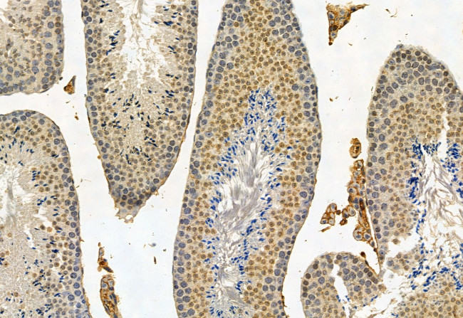 CRBN Antibody in Immunohistochemistry (Paraffin) (IHC (P))