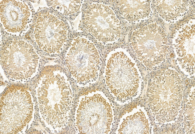 CRBN Antibody in Immunohistochemistry (Paraffin) (IHC (P))