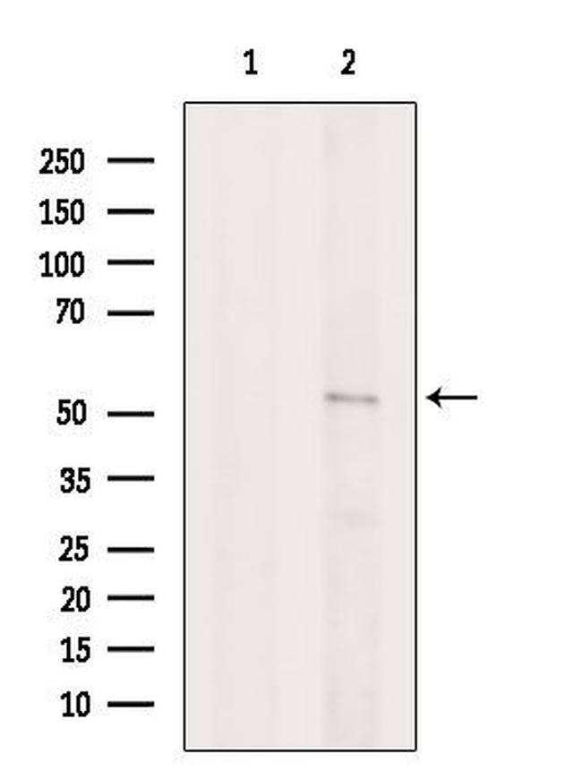 CRBN Antibody in Western Blot (WB)