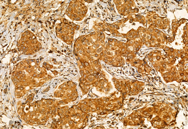 CHKA Antibody in Immunohistochemistry (Paraffin) (IHC (P))