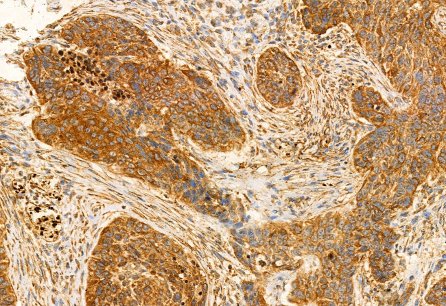 CHKA Antibody in Immunohistochemistry (Paraffin) (IHC (P))