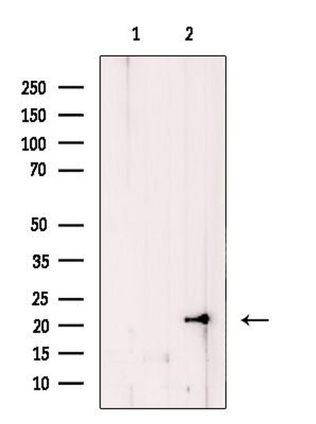 COMMD1 Antibody in Western Blot (WB)