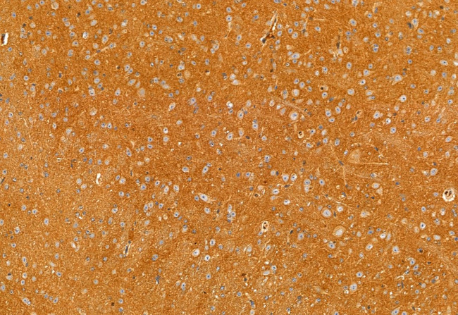 DHRS3 Antibody in Immunohistochemistry (Paraffin) (IHC (P))