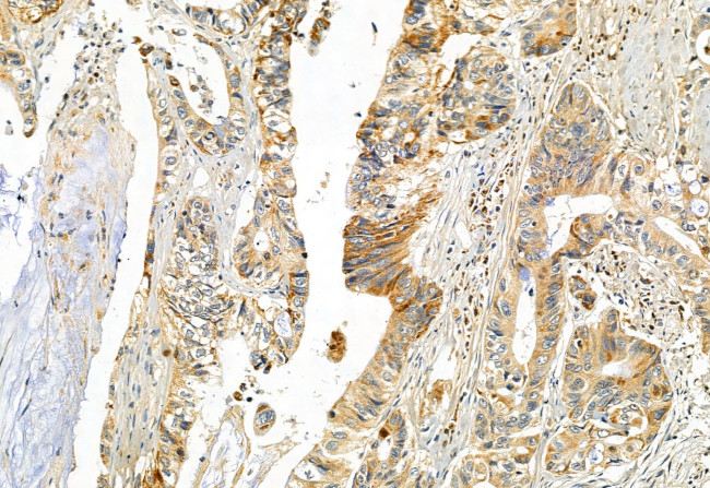 DHRS3 Antibody in Immunohistochemistry (Paraffin) (IHC (P))