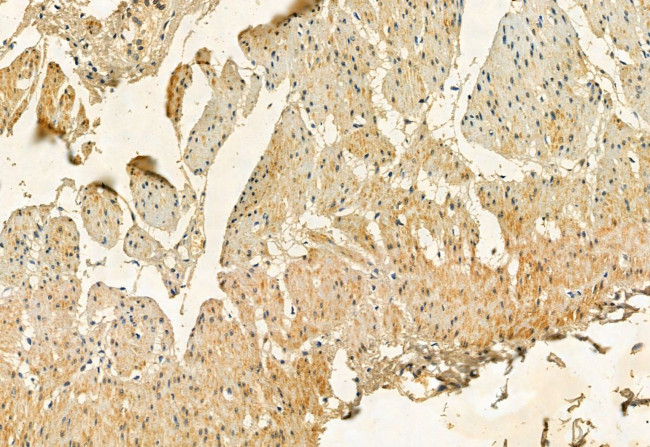 FKBP10 Antibody in Immunohistochemistry (Paraffin) (IHC (P))