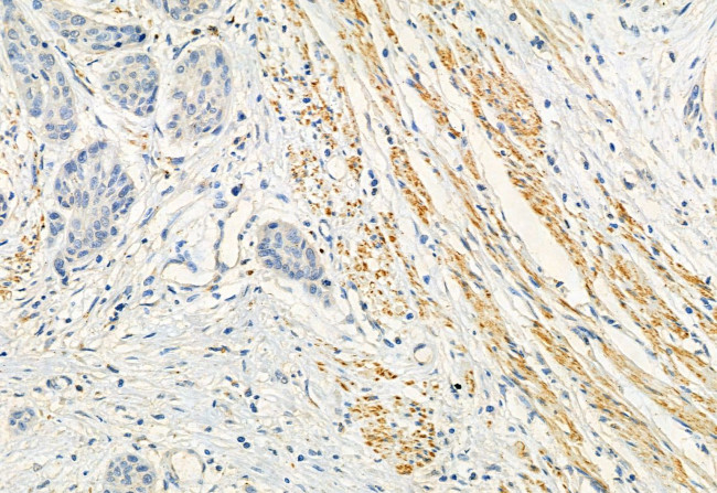 FKBP10 Antibody in Immunohistochemistry (Paraffin) (IHC (P))